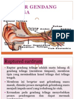 Ruptur Gendang Telinga