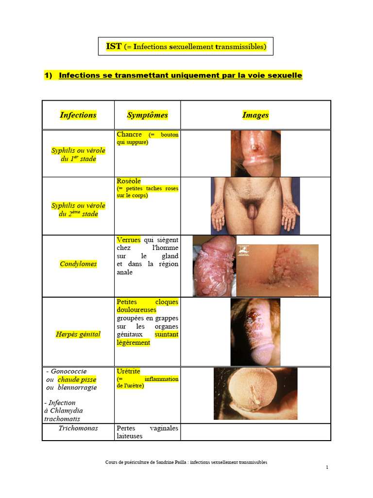 Infections Sexuellement Transmissibles : Guide | PDF | Infection ...