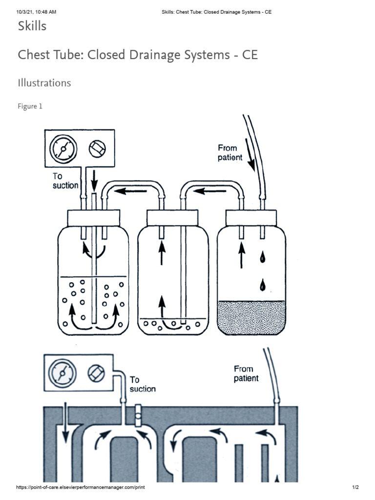 Chest Tube Closed Drainage Skills CE | PDF