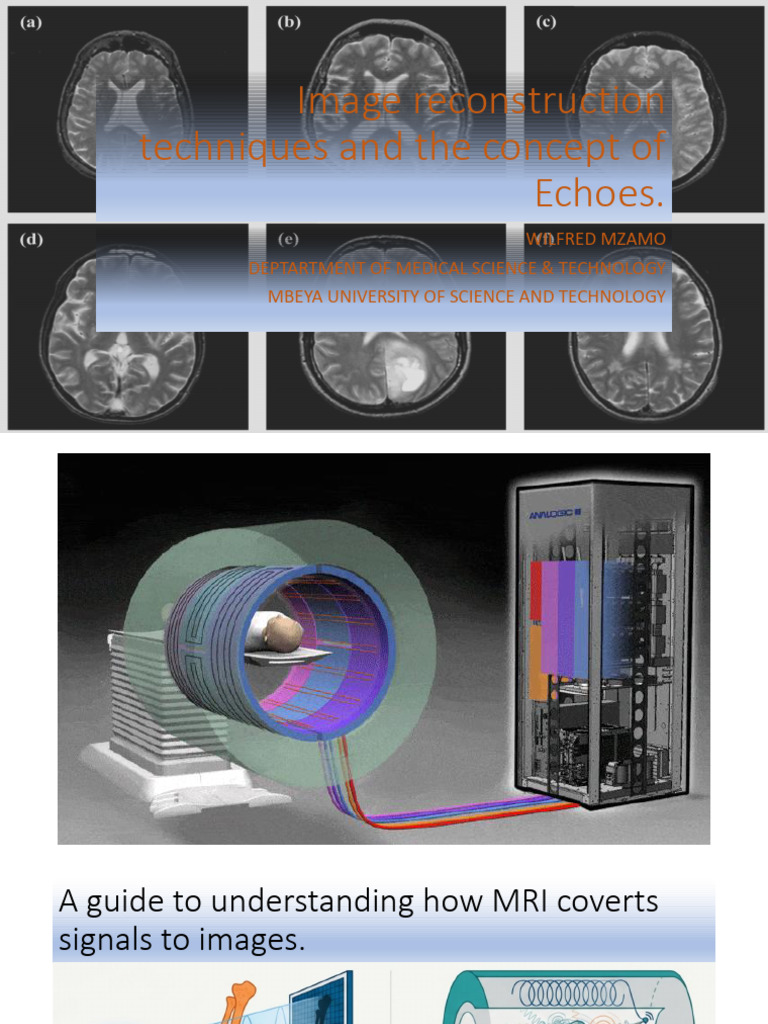 MRI Image Reconstruction Techniques | PDF | Magnetic Resonance Imaging ...