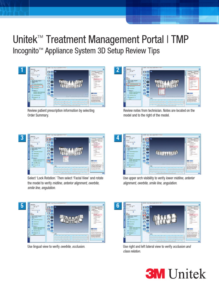 TMP 3D Setup Review Tips | PDF | Face | Mouth