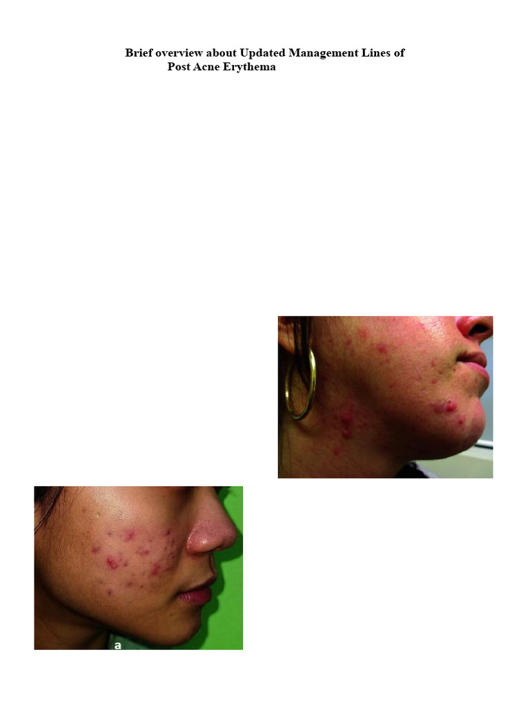 EJHM Volume 91 Issue 1 Pages 4294-4297 | PDF | Inflammation | Clinical ...