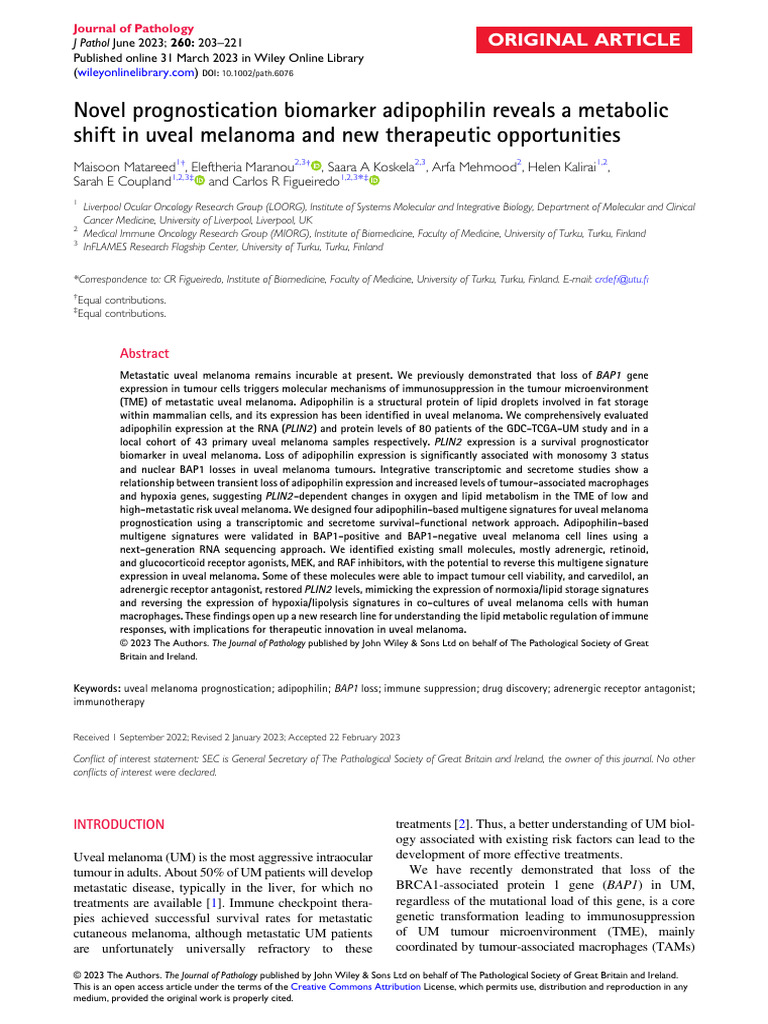 Adipophilin as Prognostic Biomarker in Uveal Melanoma | PDF | Melanoma ...