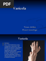 Varicela Proiect Viman Adelina