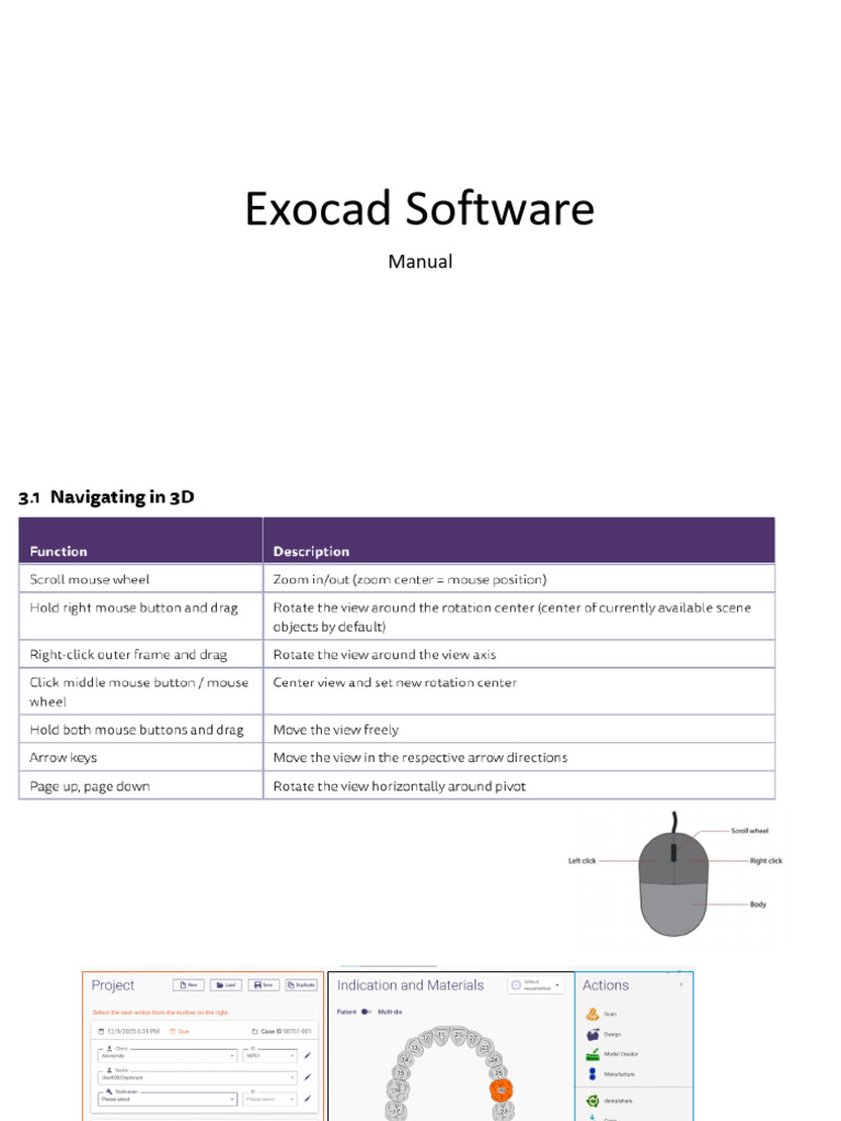 Exocad Software Manual Overview | PDF