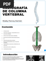 Radiología de la Columna Vertebral: Guía Completa | PDF | La columna ...