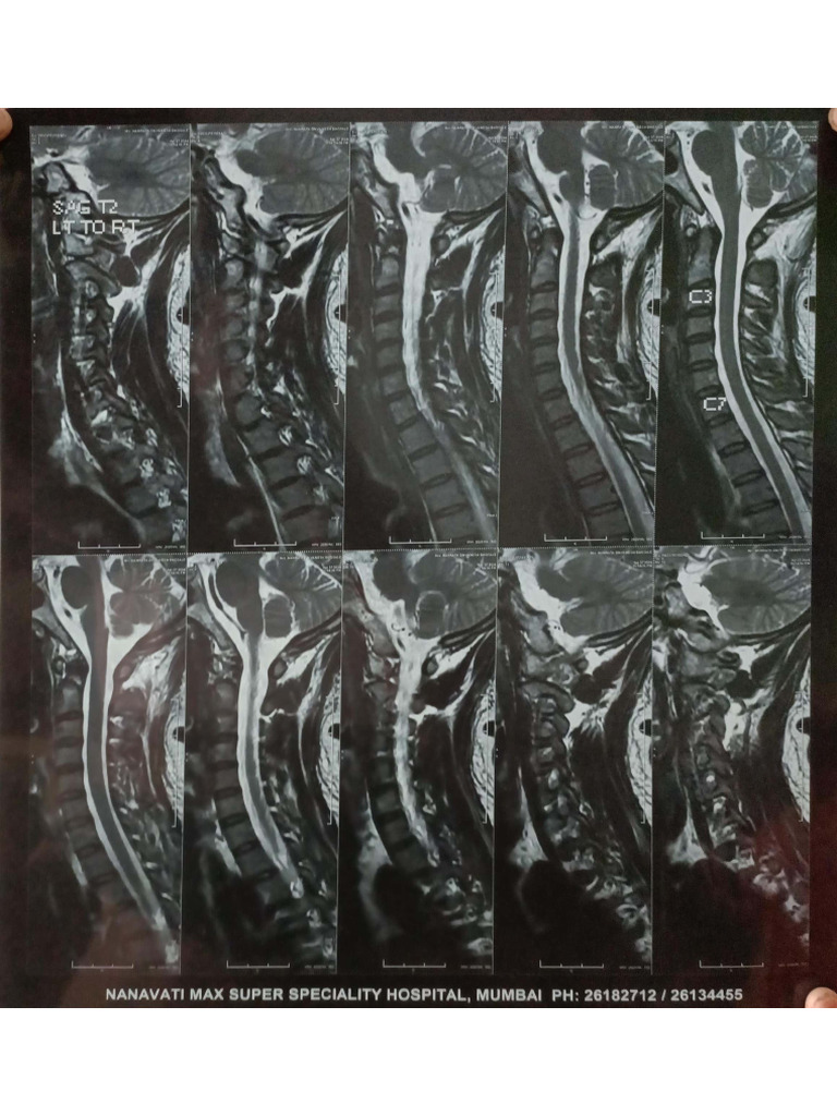 Mri | PDF