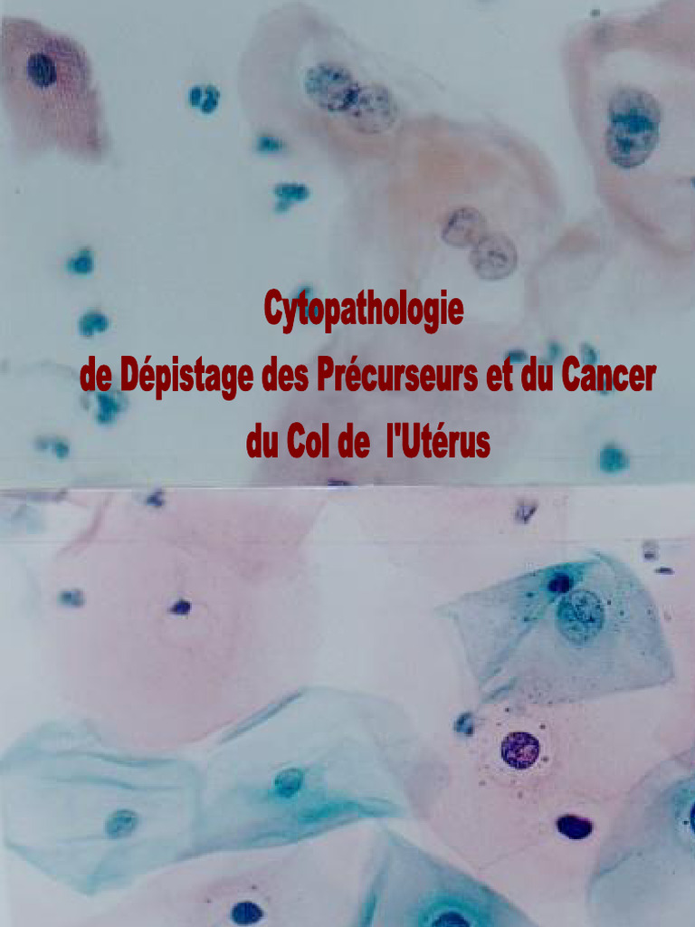 Manuel de Dépistage du Cancer du Col | PDF | Inflammation | Utérus