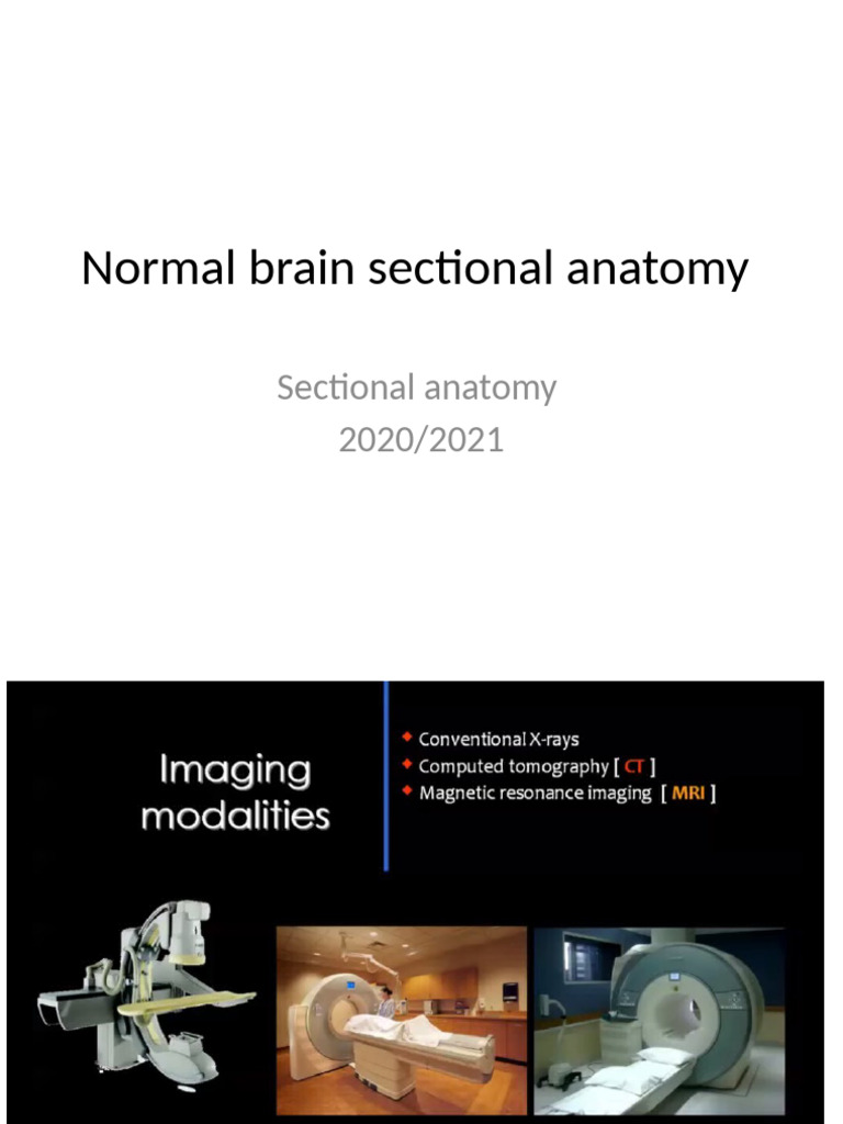 Normal Brain Sectional Anatomy | PDF