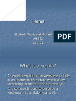 Hernia