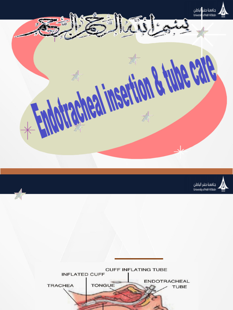 Endotracheal Tube Insertion Guide | PDF | Respiratory Tract | Surgery