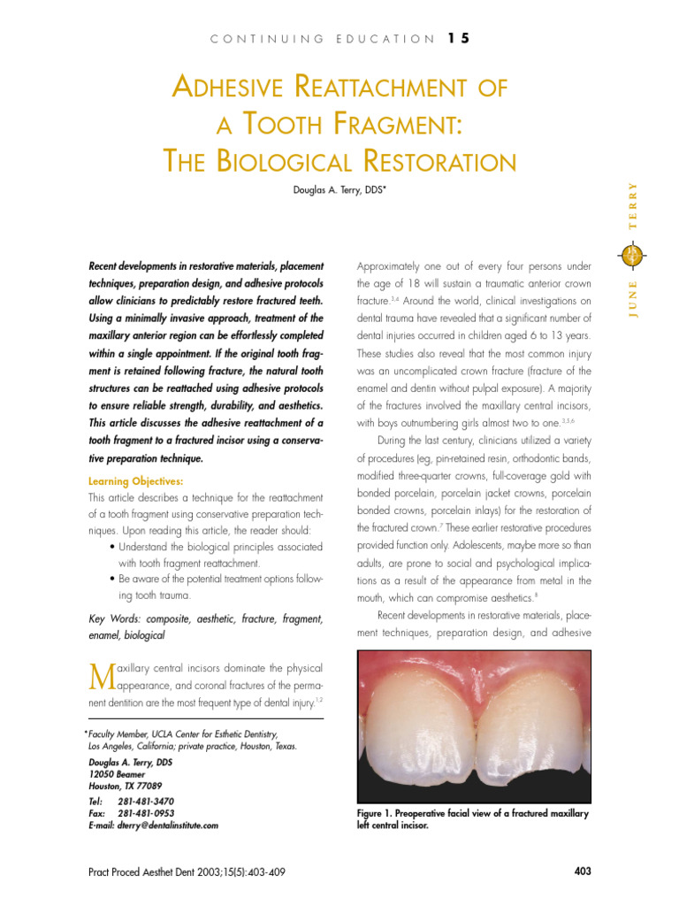Adhesive Tooth Fragment Reattachment Techniques | PDF | Human Tooth ...