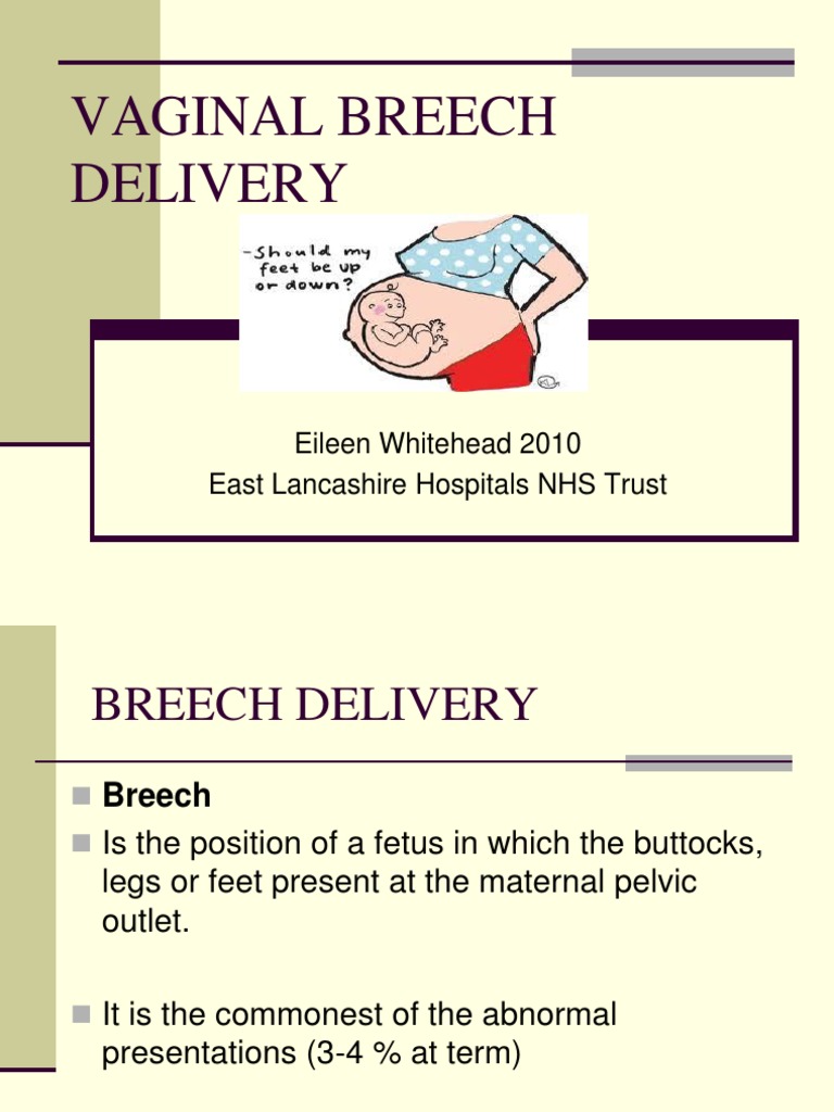 Breech baby superstitions image