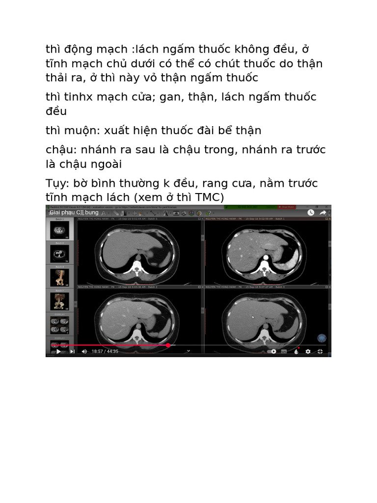 CT | PDF