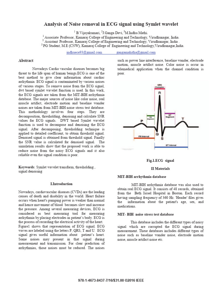 Analysis of Noise Removal in ECG Signal Using Symlet Wavelet | PDF ...