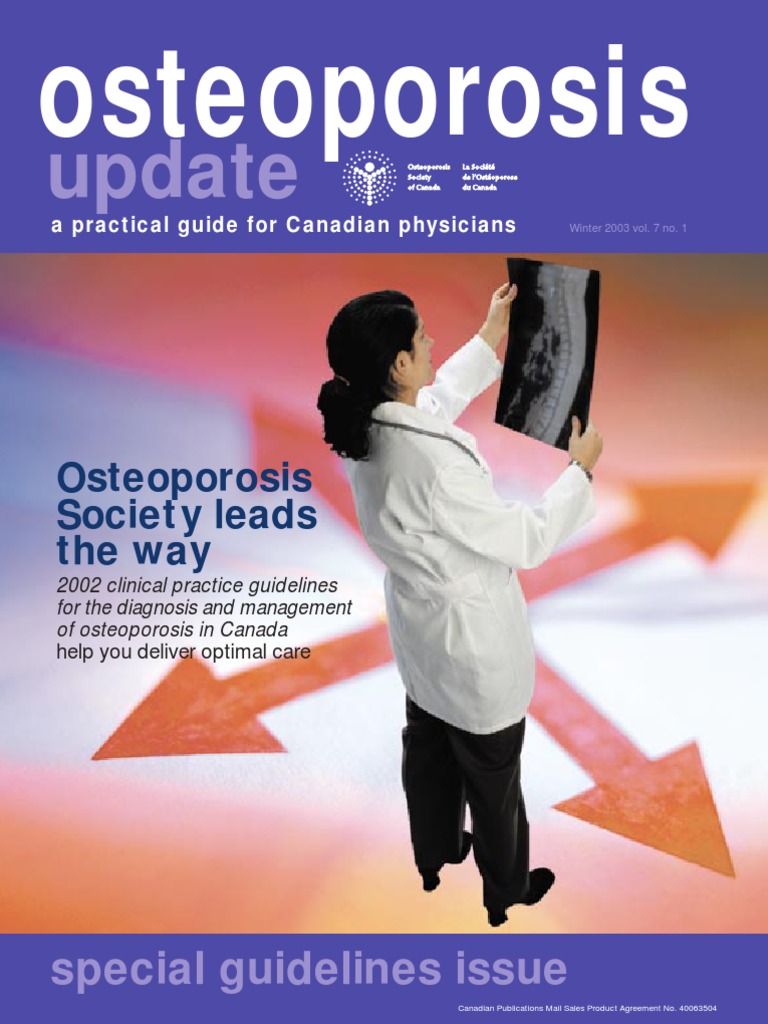 Update: Osteoporosis | PDF | Osteoporosis | Clinical Medicine