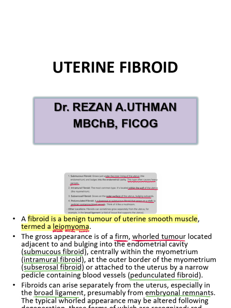 approach to uterine fibroid | PDF | Uterus | Medical Specialties