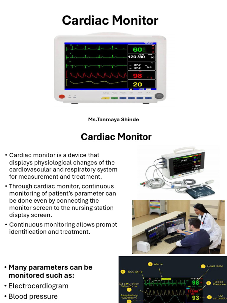 Cardiac Monitor | PDF