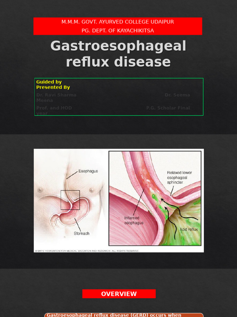 Understanding Gastroesophageal Reflux Disease | PDF | Gastroesophageal ...