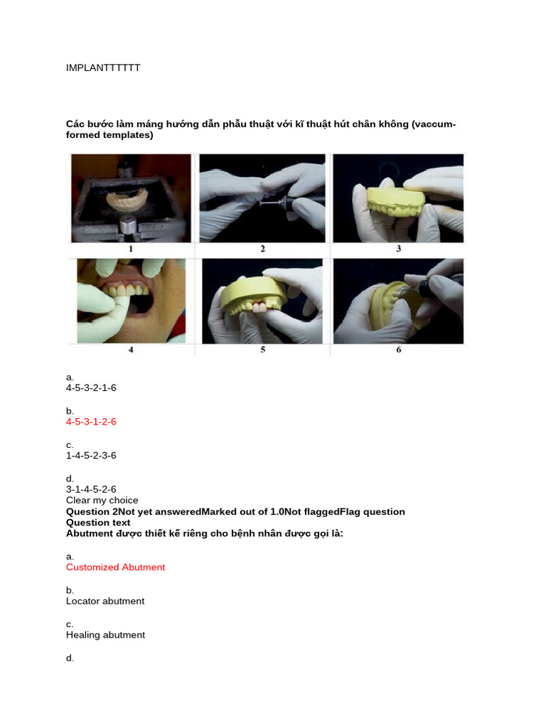 Implant TTTTT | PDF