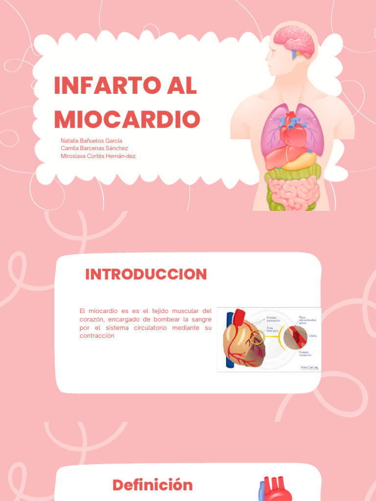 Infarto de Miocardio: Causas y Síntomas | PDF | Infarto de miocardio ...