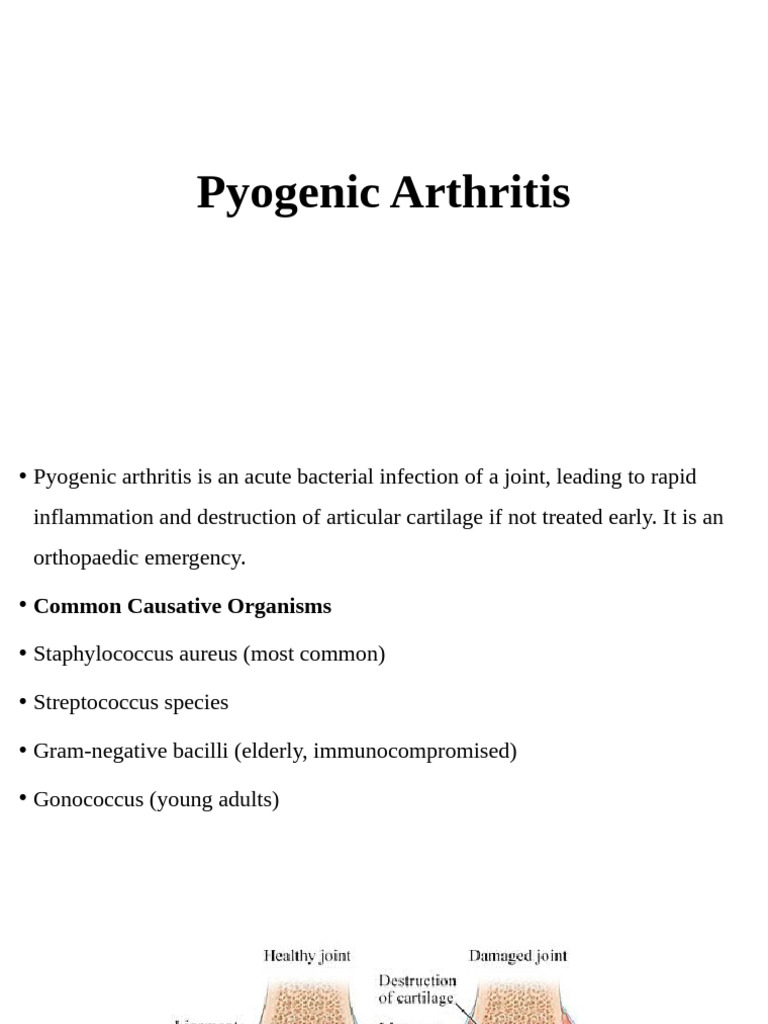 Pyogenic Arthritis: Causes, Diagnosis, and Treatment | PDF | Arthritis ...