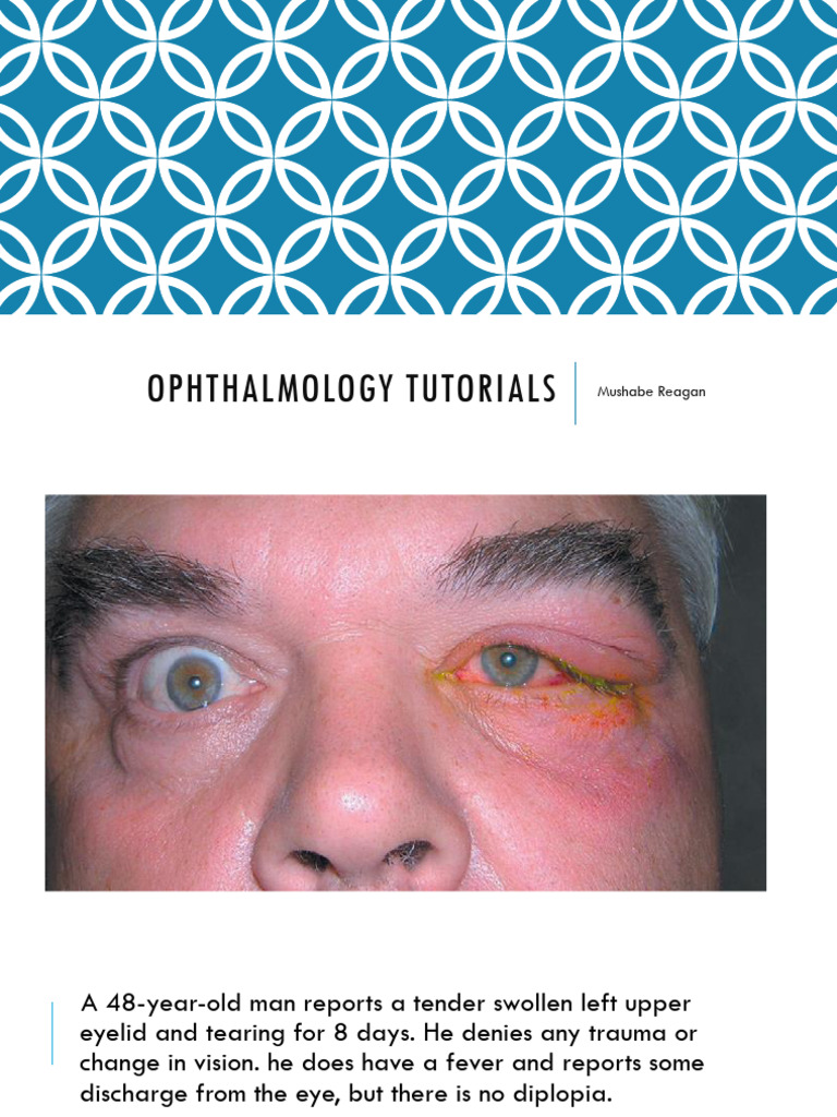 Ophthalmology tutorials | PDF | Diseases And Disorders | Human Diseases ...