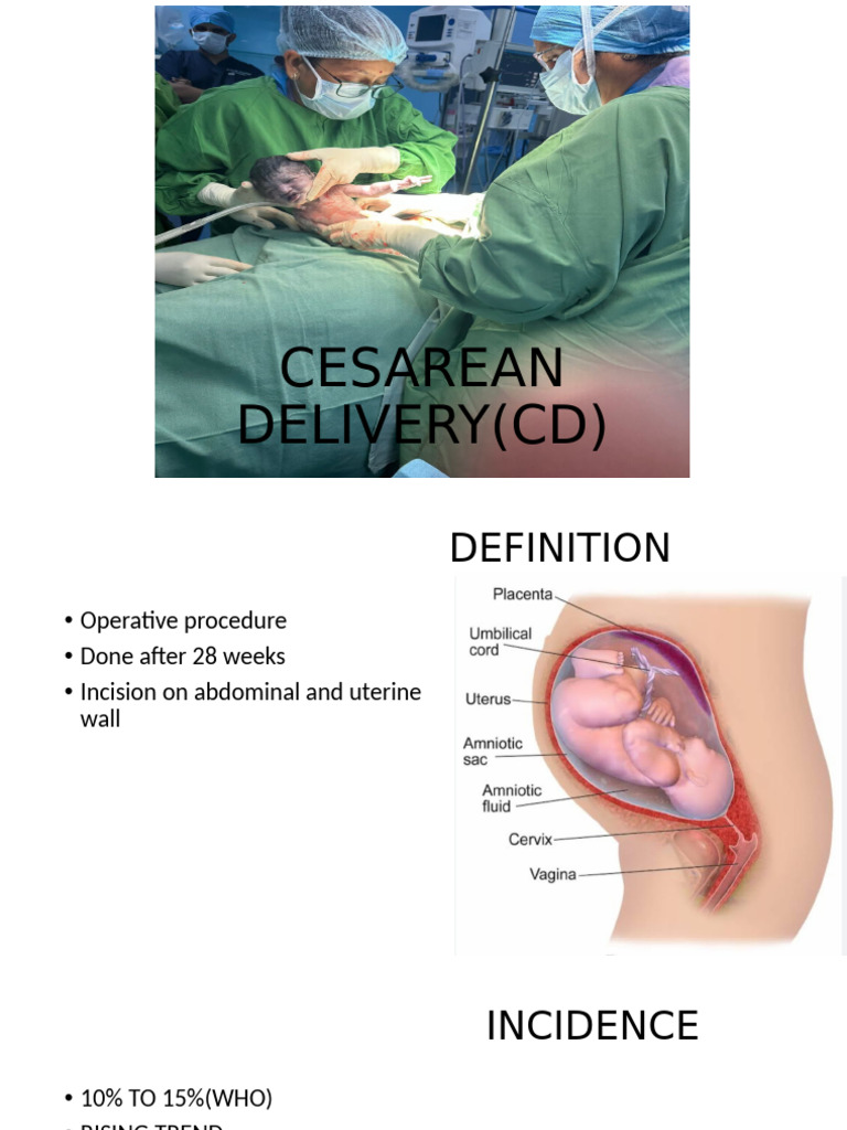Cesarean Delivery(CD) Asima Mam | PDF | Caesarean Section | Childbirth