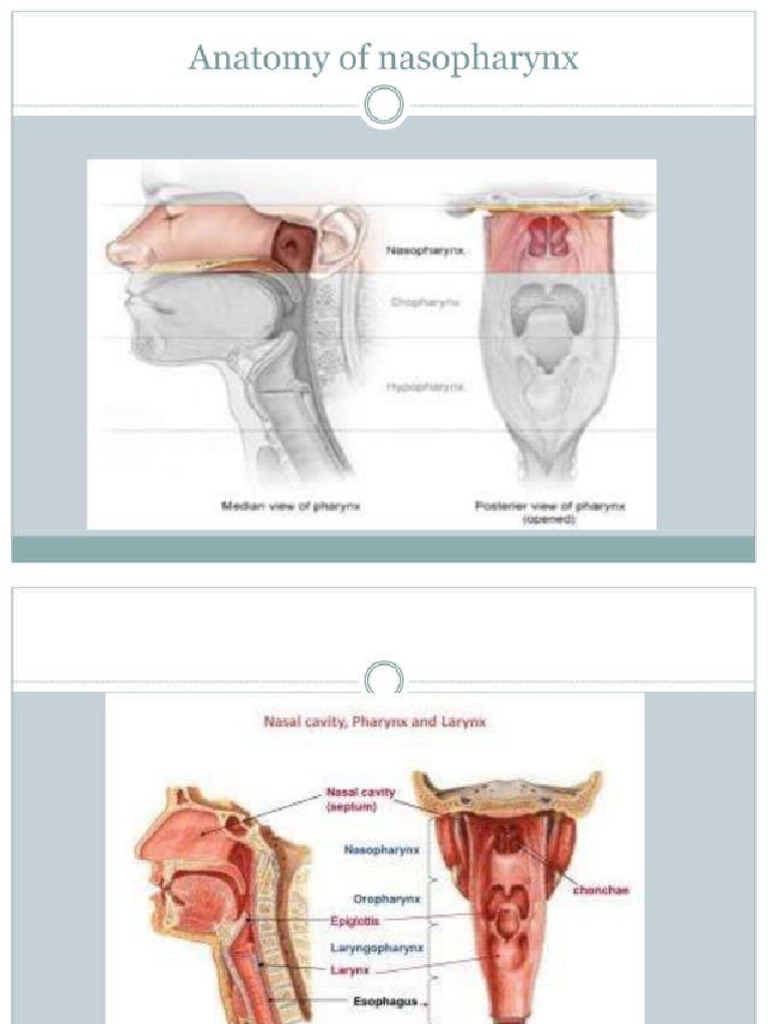 Nasopharyngeal Cancer | PDF