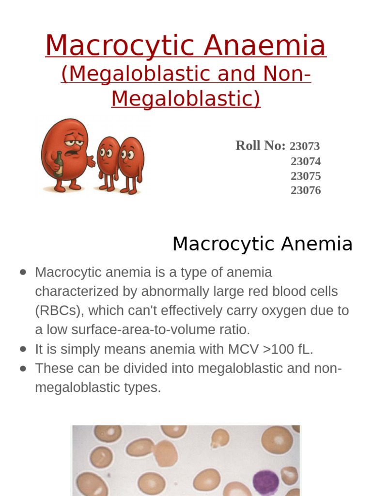 Macrocytic Anemia | PDF | Vitamin B12 | Anemia