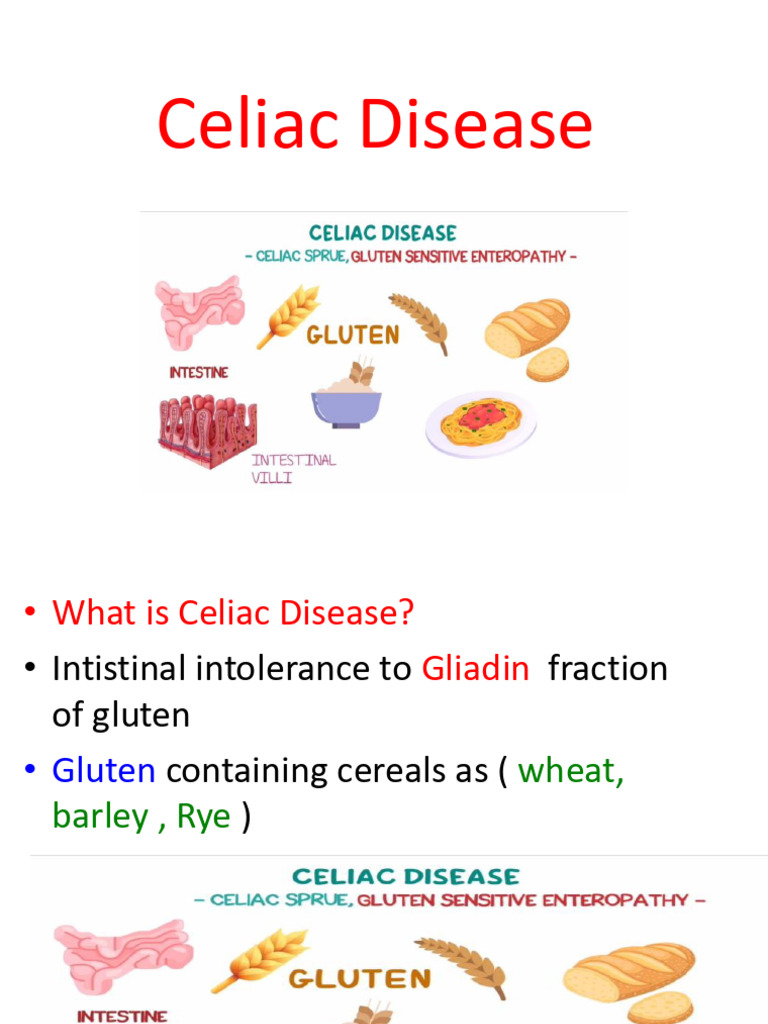 Understanding Celiac Disease Symptoms & Treatment | PDF
