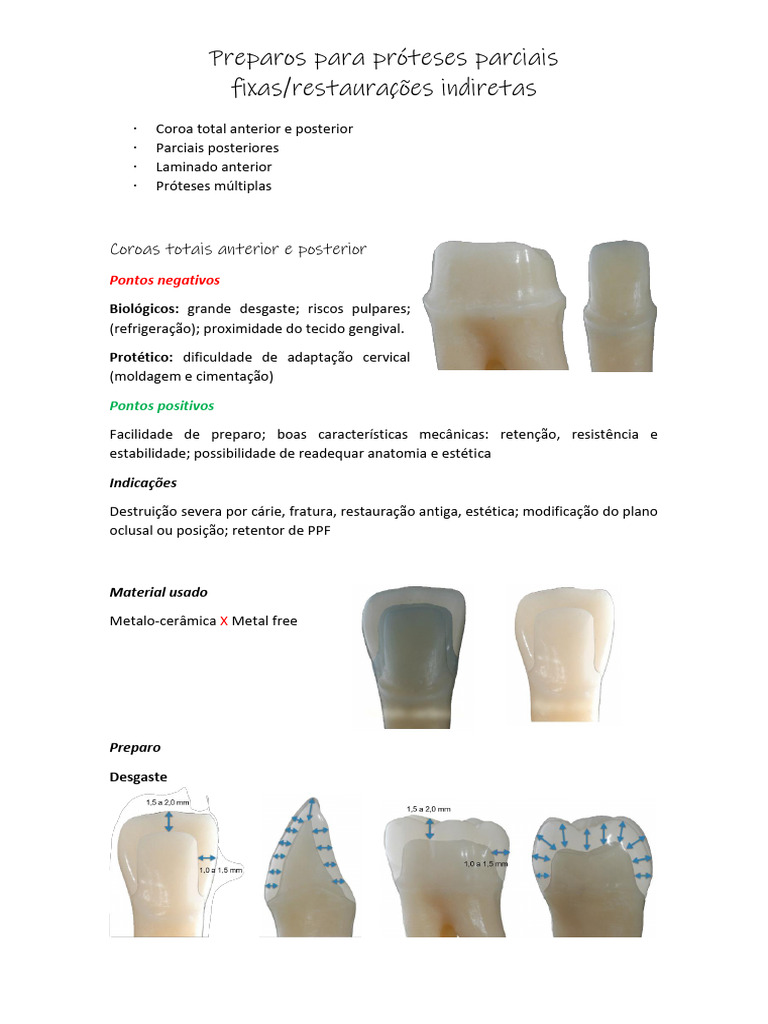 Preparos para Próteses Parciais e Restaurações | PDF | Dente humano ...