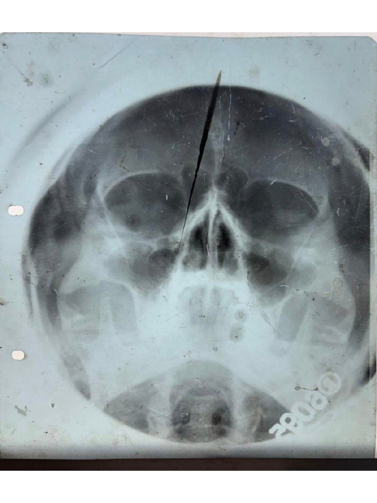 Radiology | PDF
