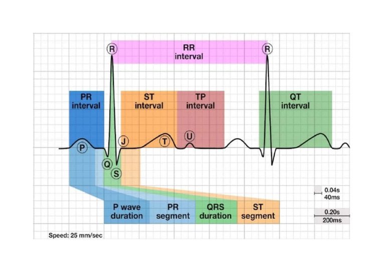 ECG Pic | PDF