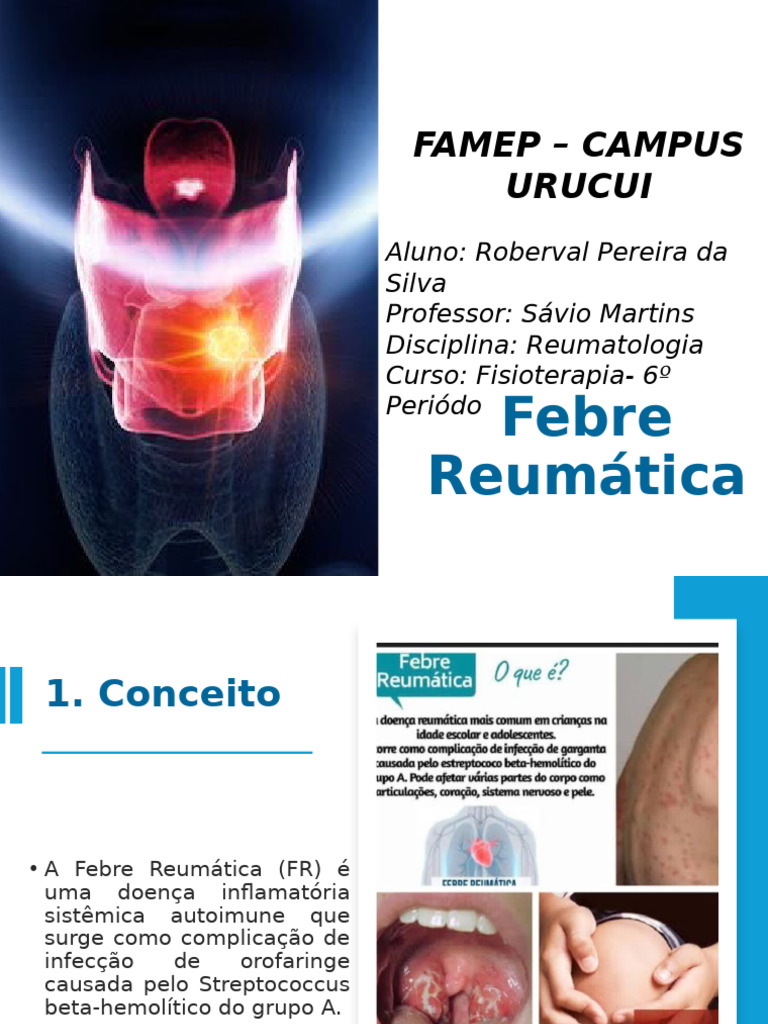 Febre Reumática: Causas e Tratamento | PDF