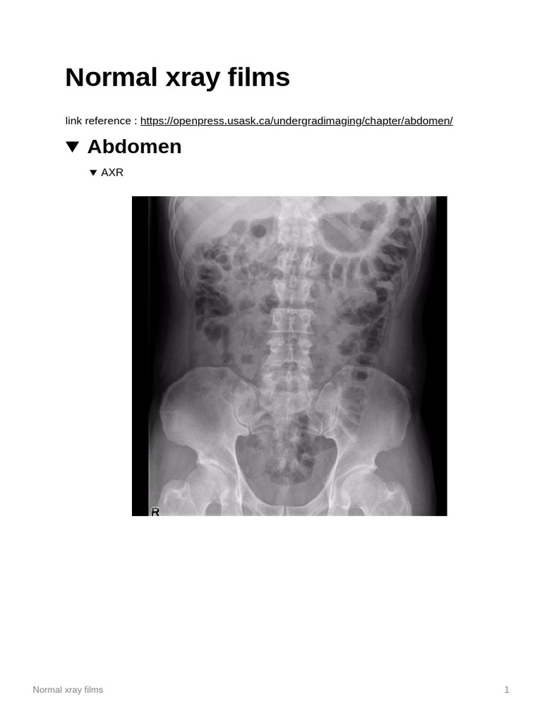 Normal Xray Films | PDF