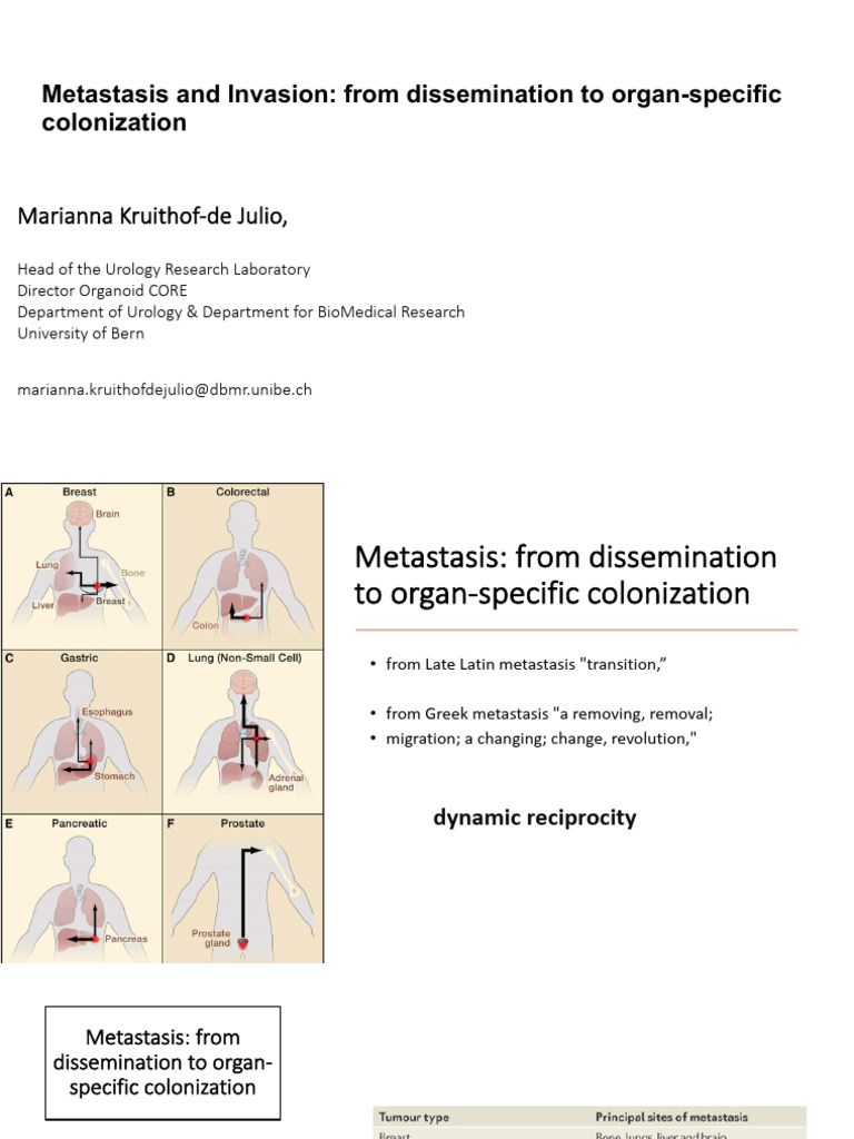 Understanding Cancer Metastasis Mechanisms | PDF | Metastasis | Medical ...