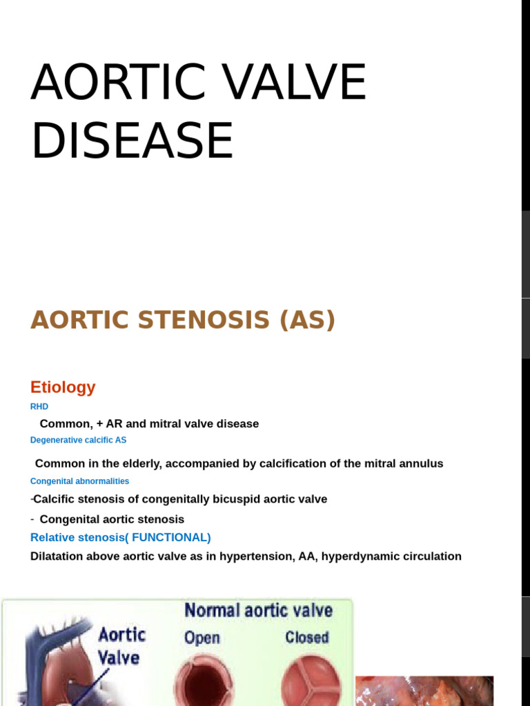 Aortic Valve Disease: Stenosis & Regurgitation | PDF | Heart | Heart Valve