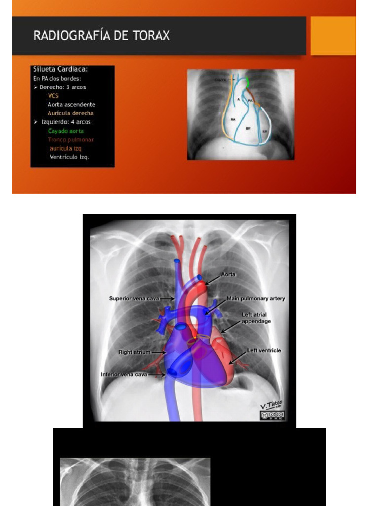Alumnos Rx Torax | PDF
