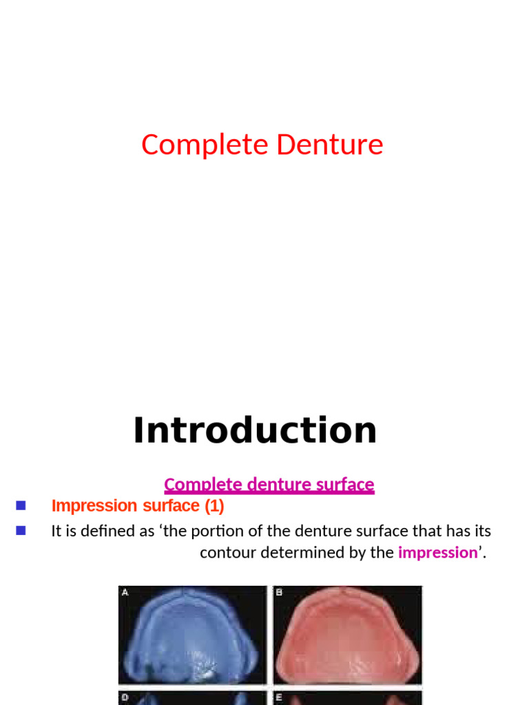 2nd Lec 2 Prosthodontic | PDF | Dentures | Dentistry