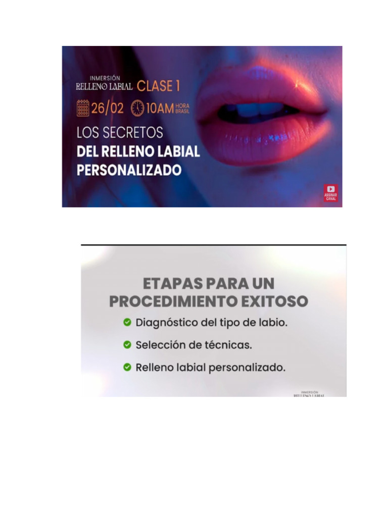 Relleno Labial Clase 1 | PDF