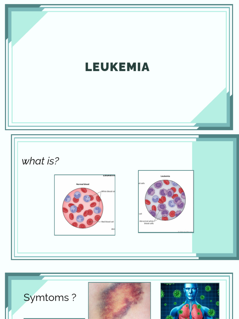 Leukemia (1) | PDF