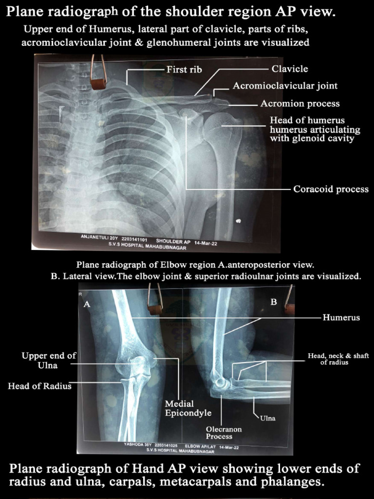 MBBS Radiology | PDF