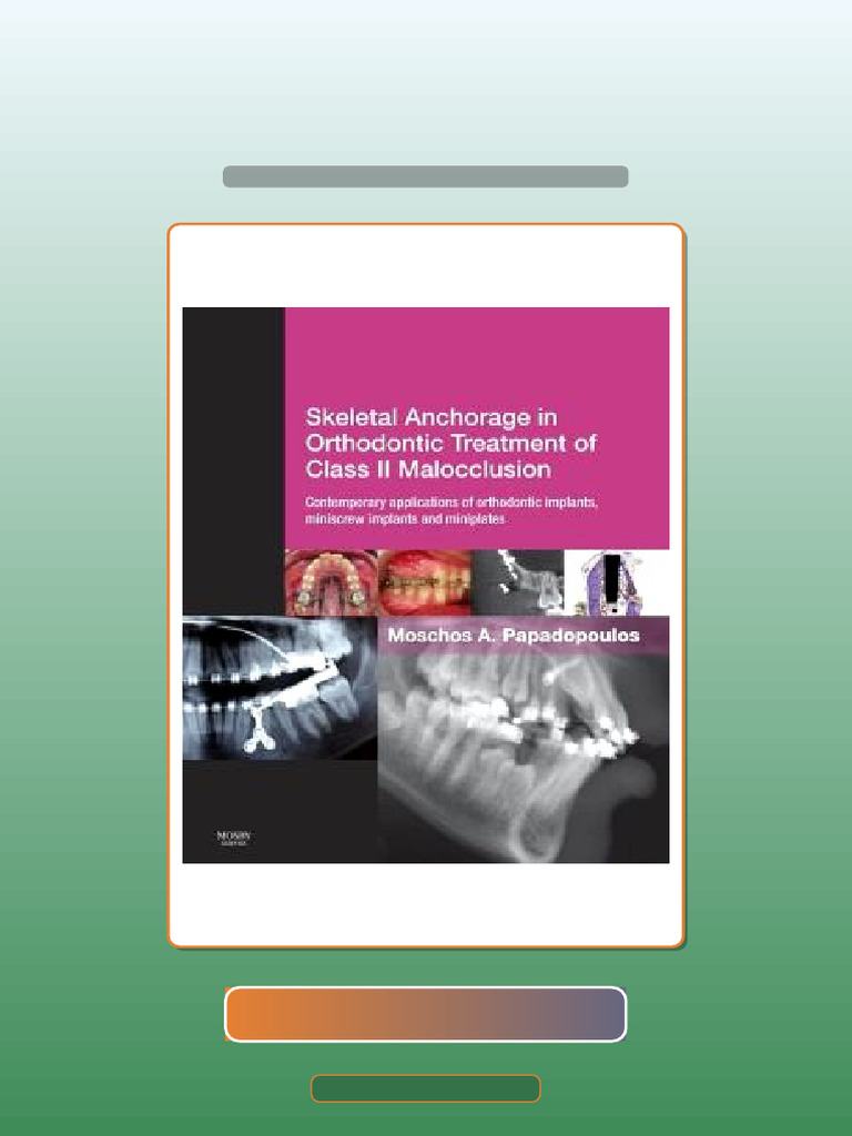 Test Bank for Skeletal Anchorage in Orthodontic Treatment of Class II ...