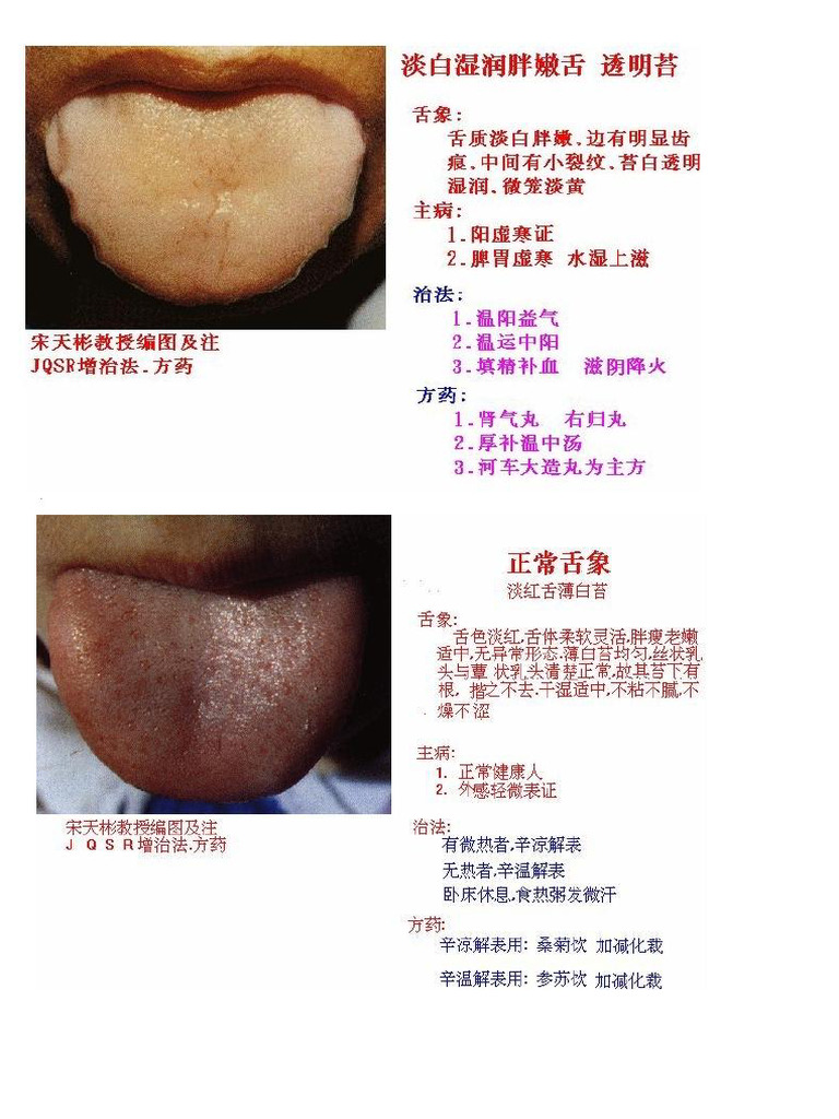 舌像全解 | PDF
