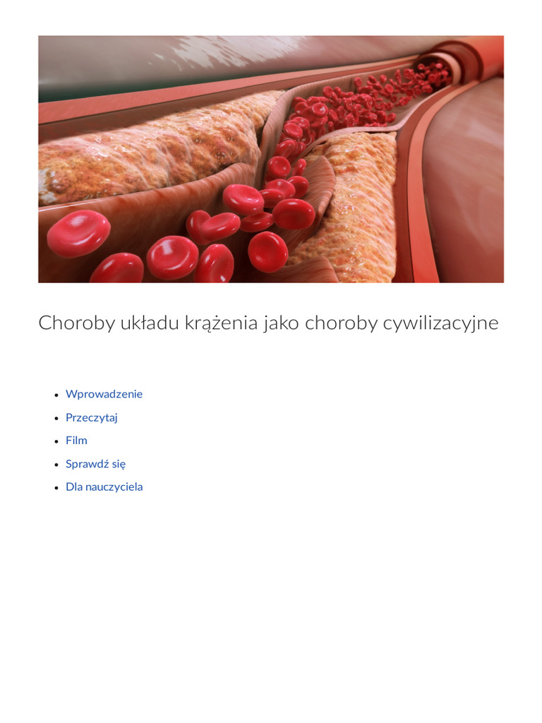 Choroby Ukladu Krazenia Jako Choroby Cywilizacyjne | PDF