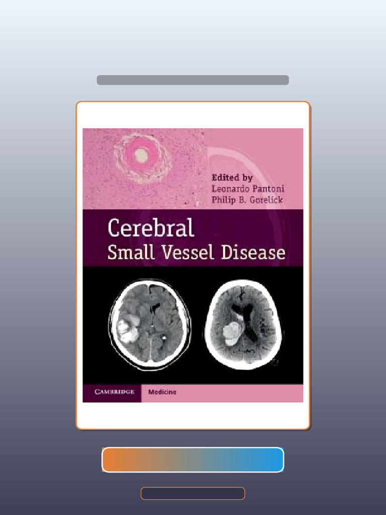 Test Bank for Cerebral Small Vessel Disease | PDF | Multiple Choice ...