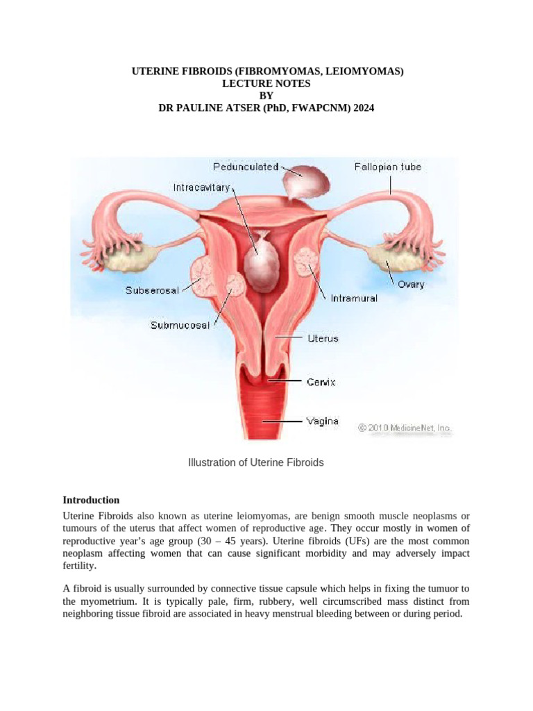 Uterine Fibroids | PDF | Uterus | Medical Specialties