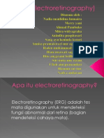 Electro Retino Graphy