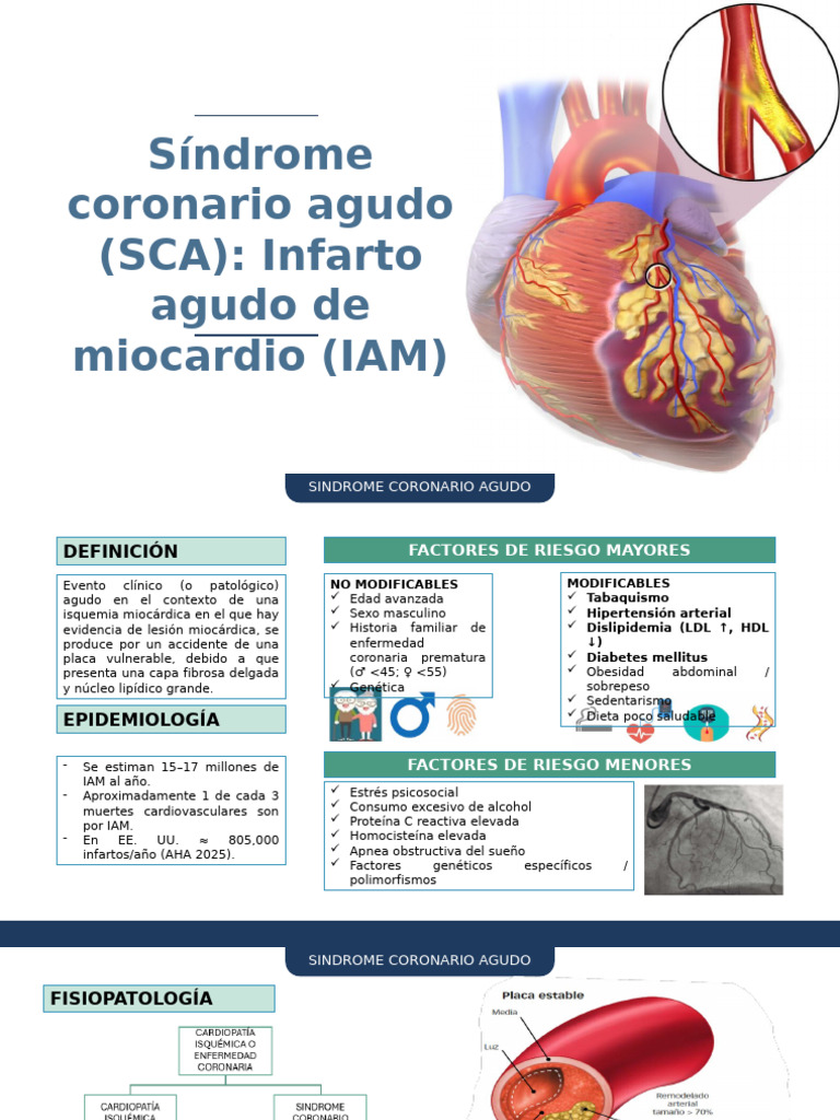 21. Sd Coronario Agudo - Iam | PDF | Infarto de miocardio ...